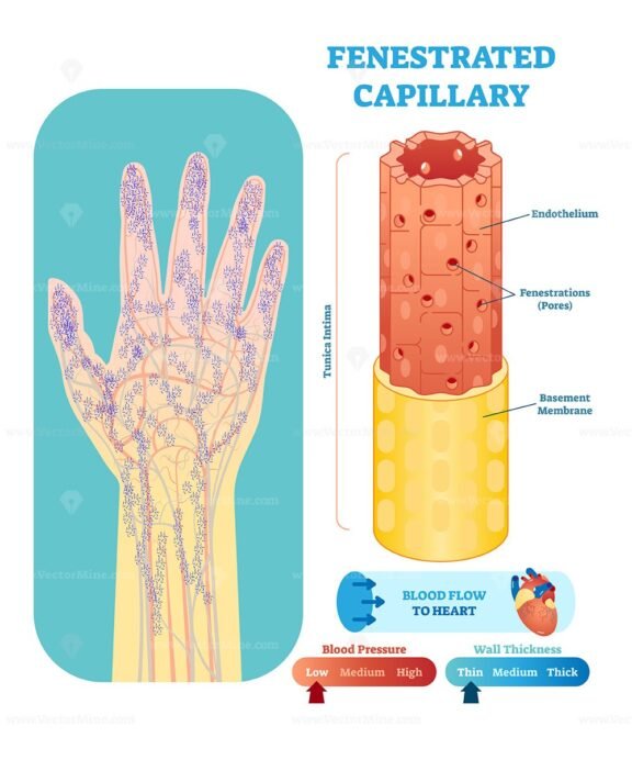 Fenestrated Capillary