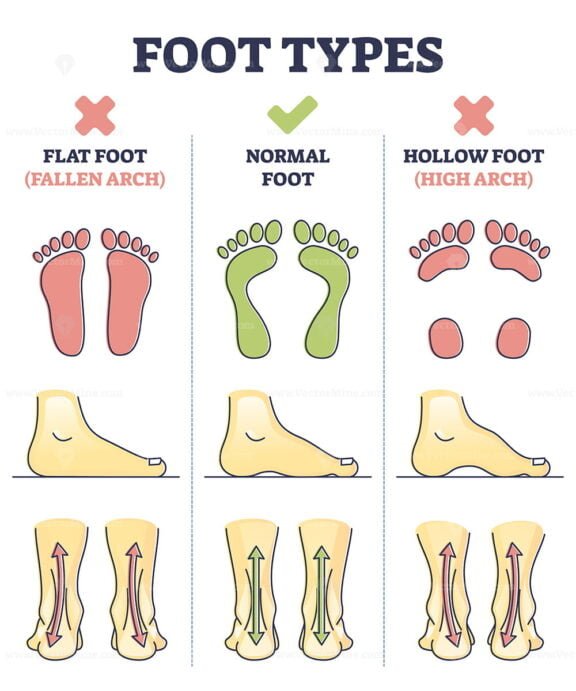 Foot Types outline