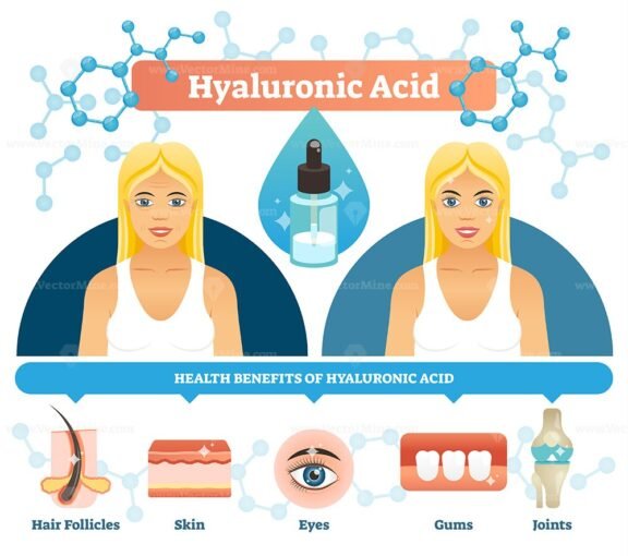 Hyaluronic Acid