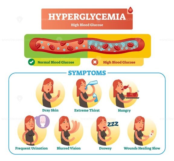 Hyperglycemia