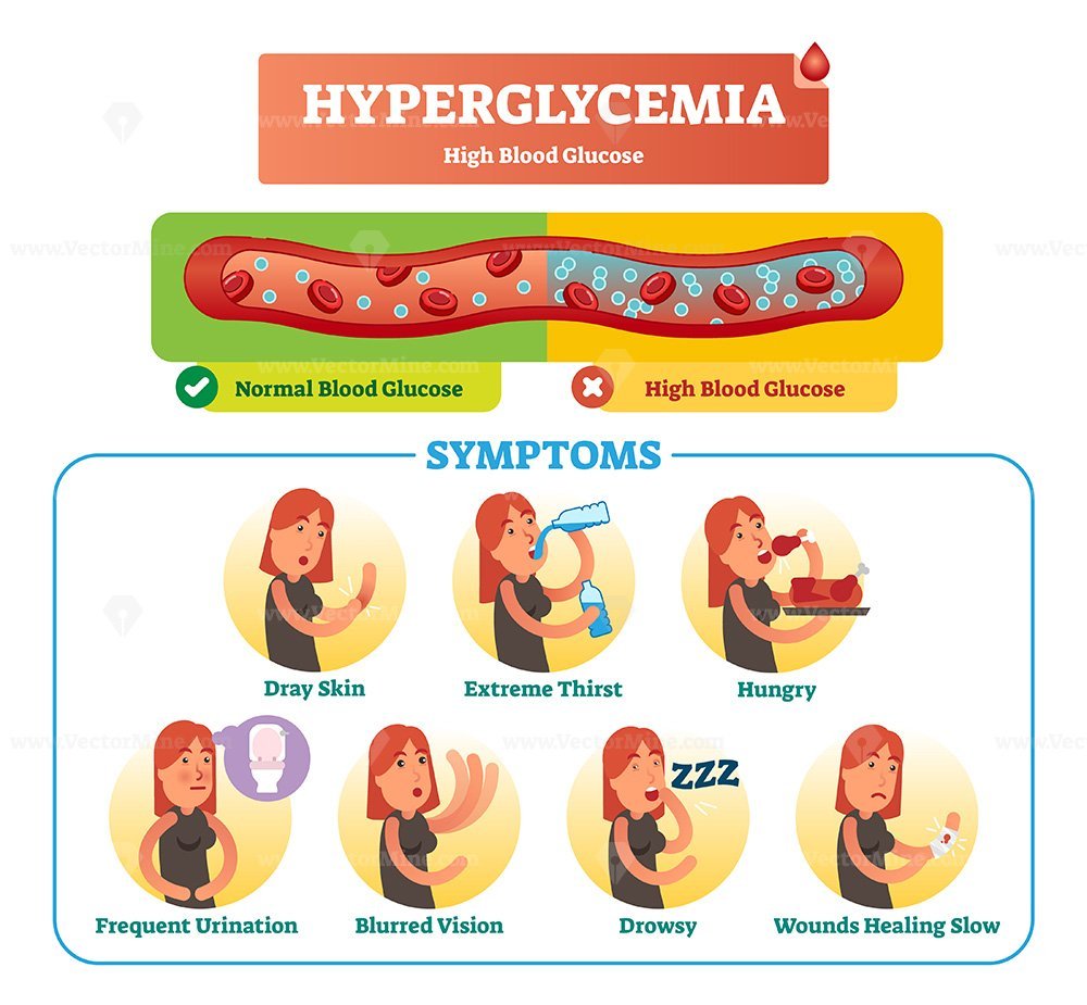 Hyperglycemia Vector Illustration Collection Set Vectormine
