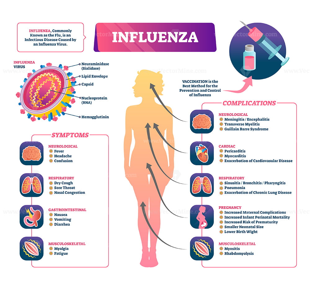 Influenza vector illustration – VectorMine