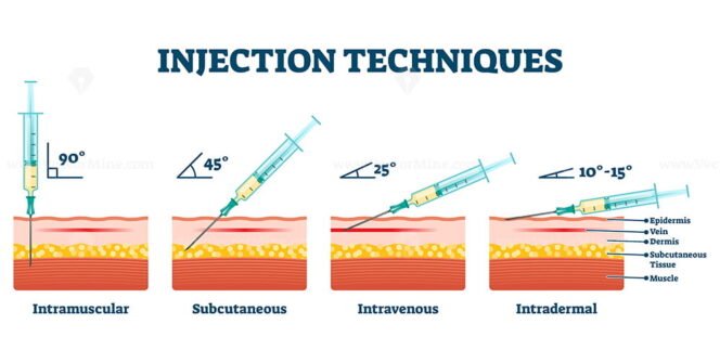Injection techniques vector illustration – VectorMine