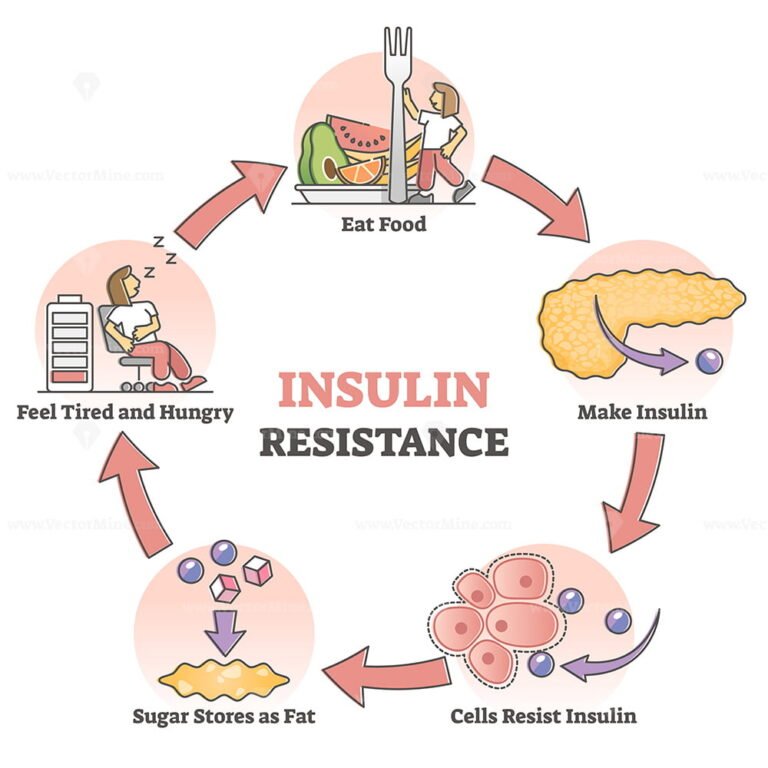 insulin-resistance-pathological-health-condition-educational-outline