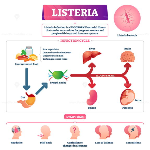 Listeria