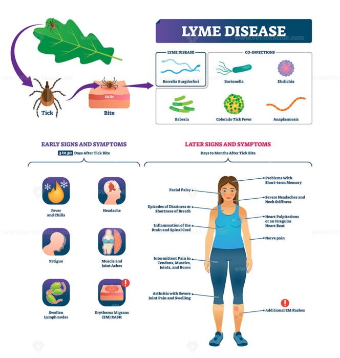 Lyme Disease Symptoms With Early And Later Illness Signs Outline ...