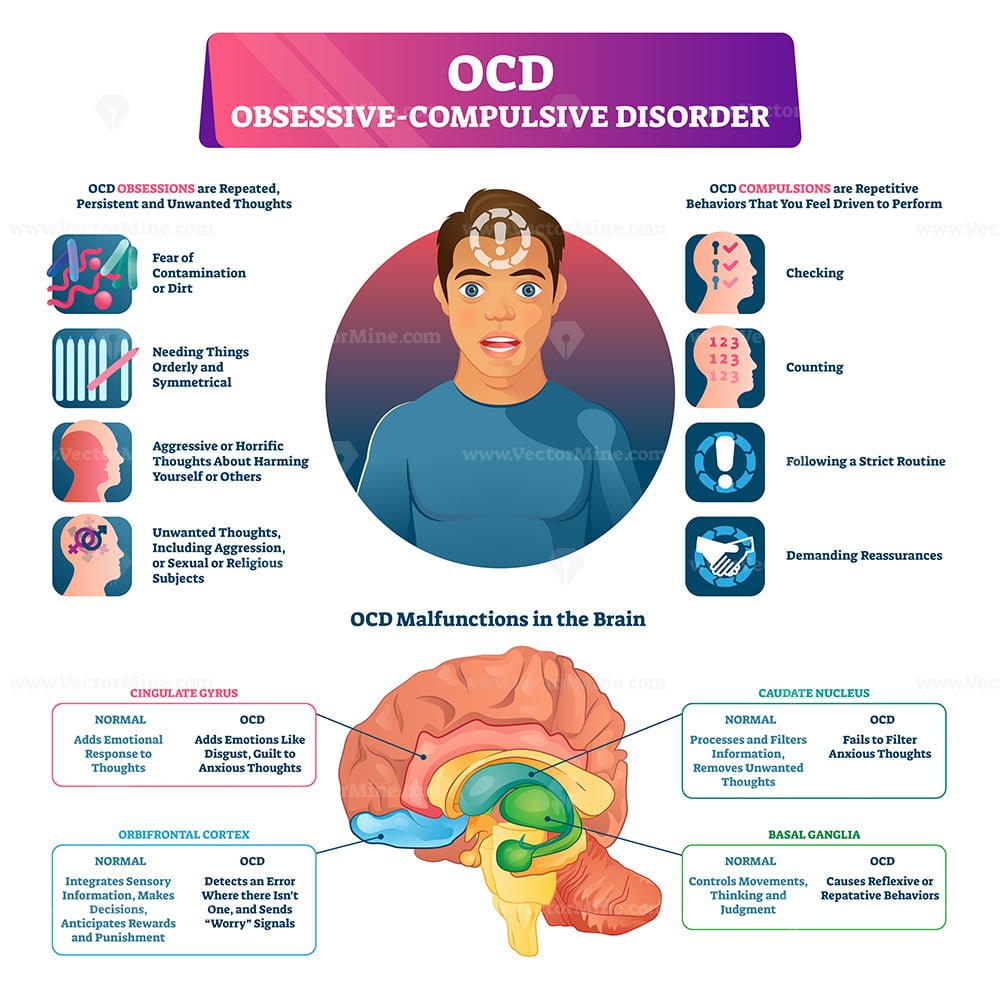 ocd-obsessive-compulsive-disorder-labeled-explanation-vector