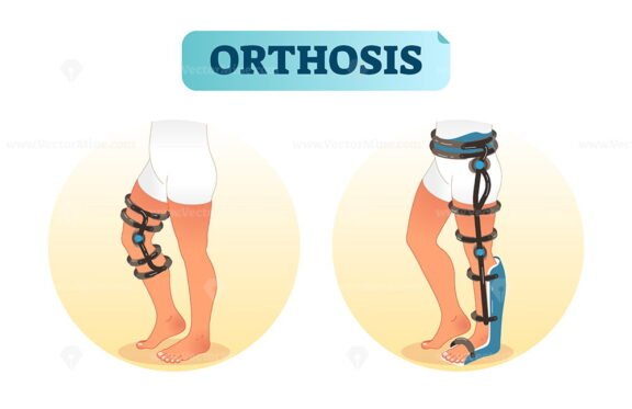 Orthosis