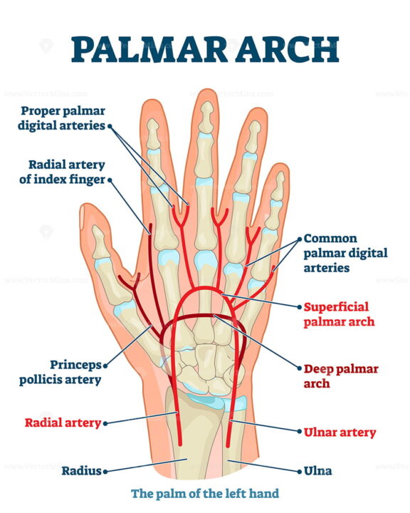 Palmar Arch