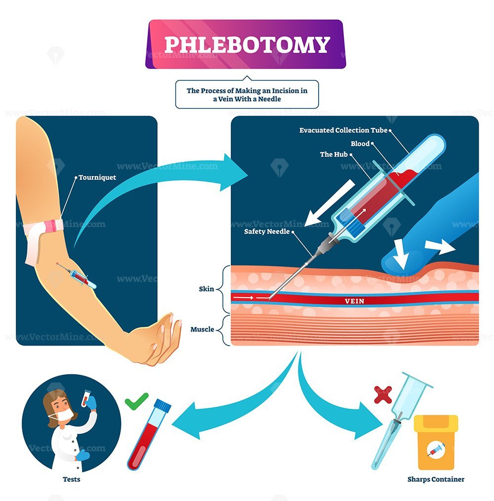 Phlebotomy vector illustration VectorMine