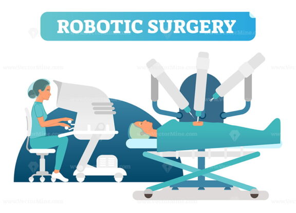 FREE Robotic surgery health care concept vector illustration scene with surgical process