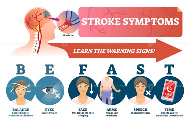 Stroke prevention and heart clot disease risk awareness outline diagram ...