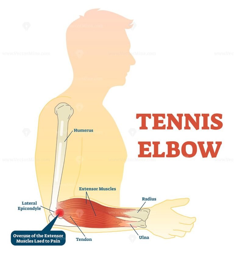 Elbow Ligaments With Medical Medial Or Lateral Xray Structure Outline Diagram Vectormine 2377