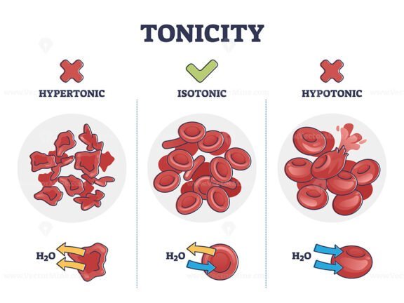 Tonicity outline diagram