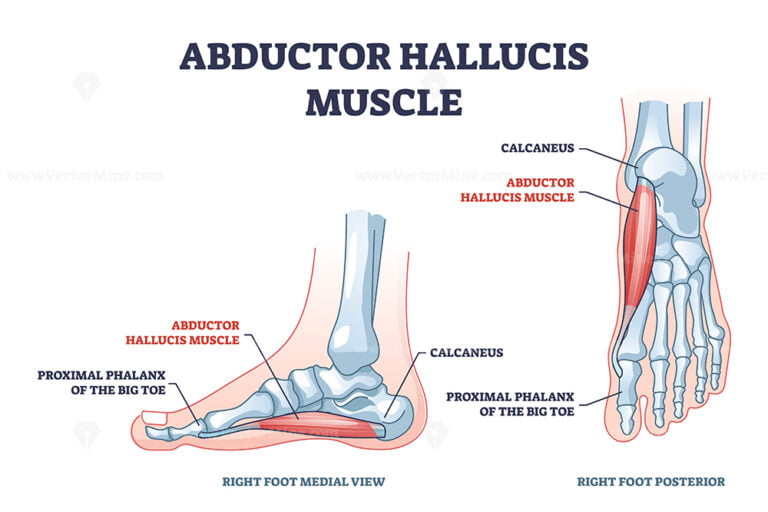 Abductor hallucis muscle with leg or foot skeletal system outline ...