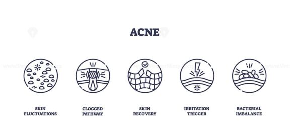 Acne icons outline key concepts like skin fluctuations, clogged pathways, and skin recovery. Outline icons set.