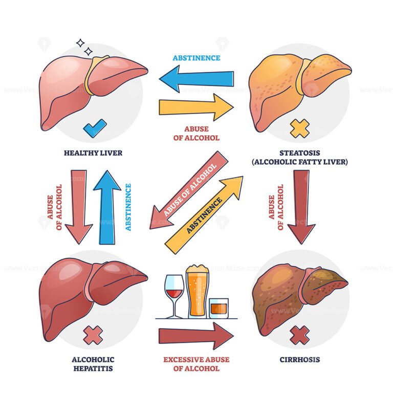 Liver damage stages with reversible and irreversible disease outline ...