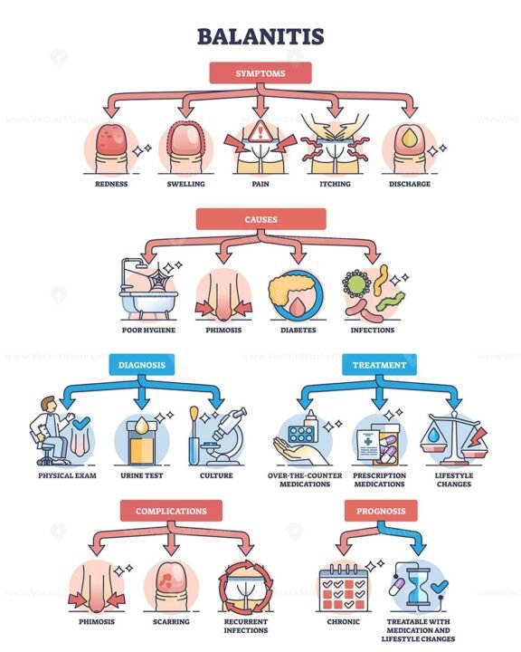 balantis outline diagram 1