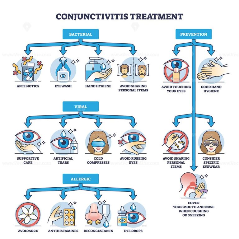 Conjunctivitis Treatment For Bacterial And Allergic Type Outline ...