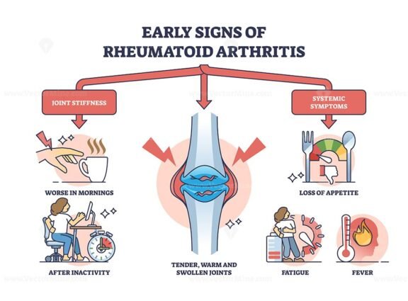 Early Signs Of Rheumatoid Arthritis Disease And Joint Pain Outline 