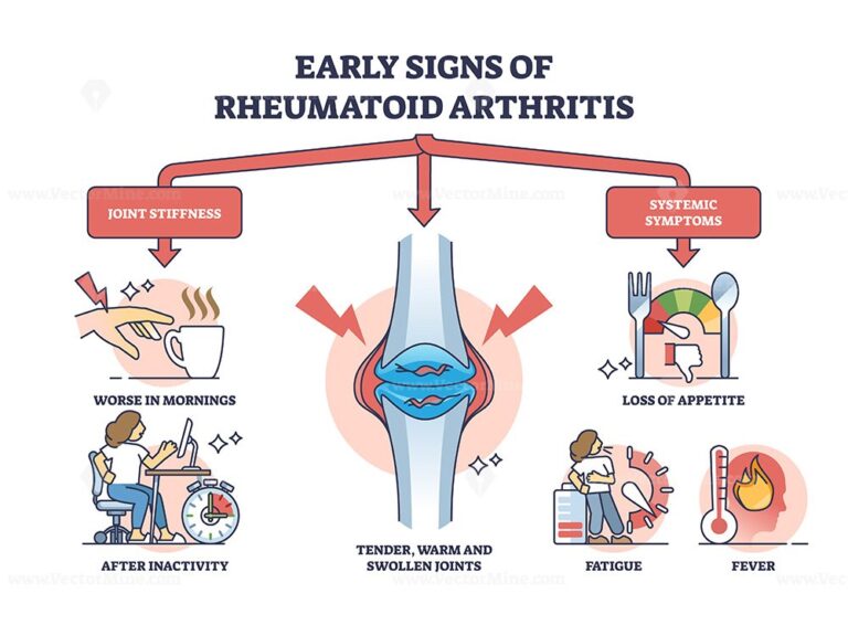 Early signs of rheumatoid arthritis disease and joint pain outline ...