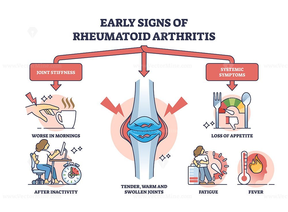 Early Signs Of Rheumatoid Arthritis Disease And Joint Pain Outline ...