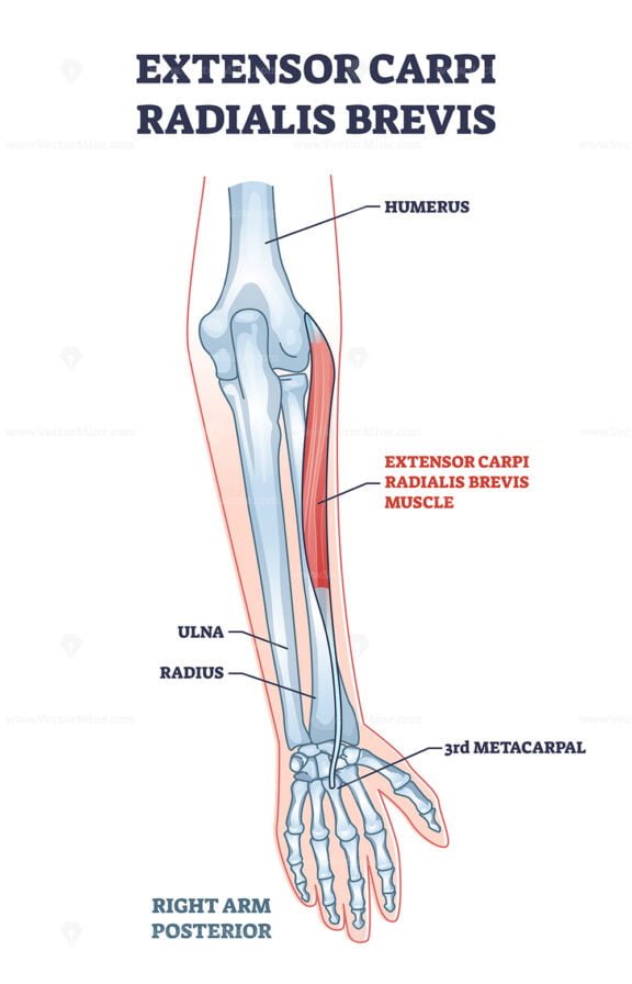 extensor carpi radialis brevis outline 1