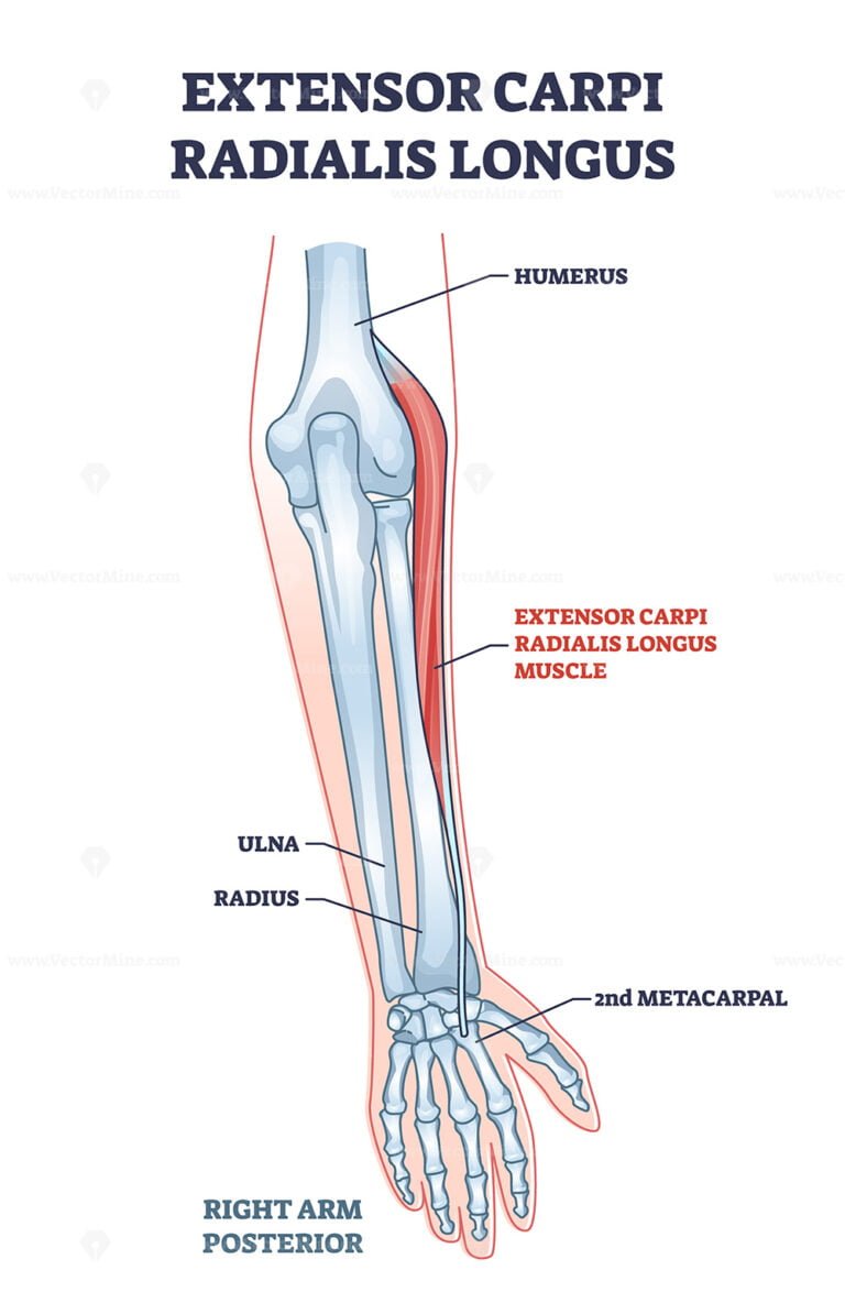 Extensor carpi radialis longus muscle with arm and hand bones outline ...