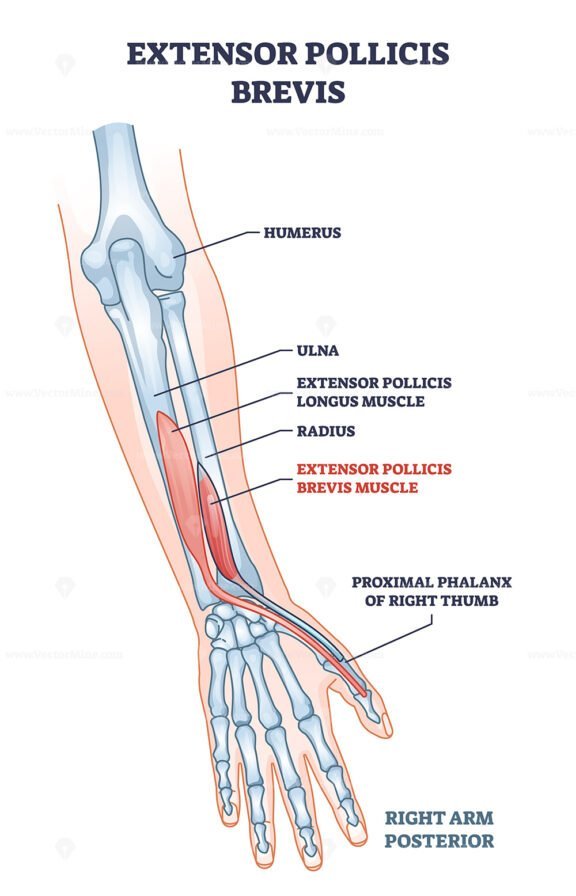 extensor pollicis brevis outline 1