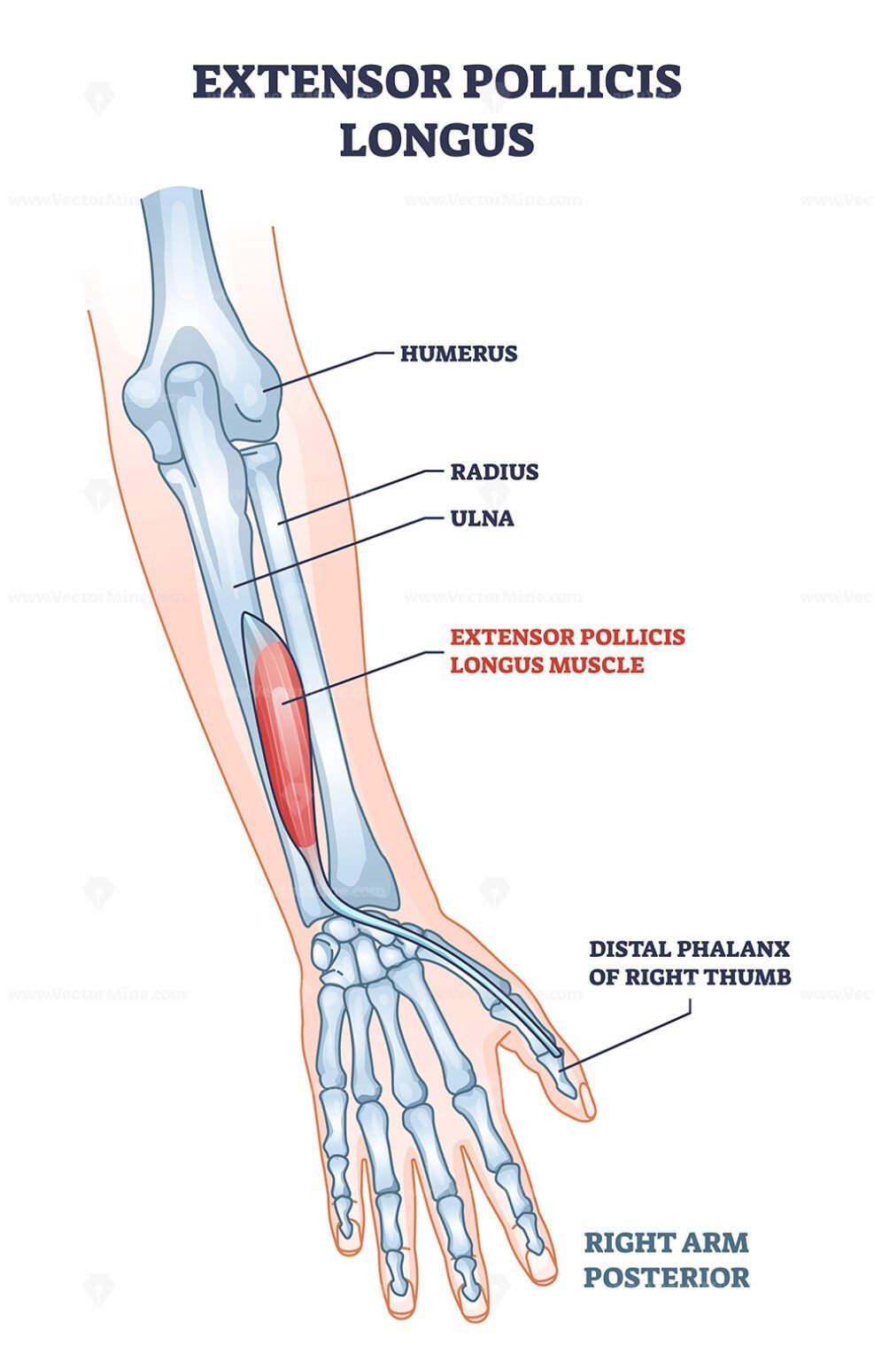 Extensor pollicis longus muscle location with arm skeleton outline ...