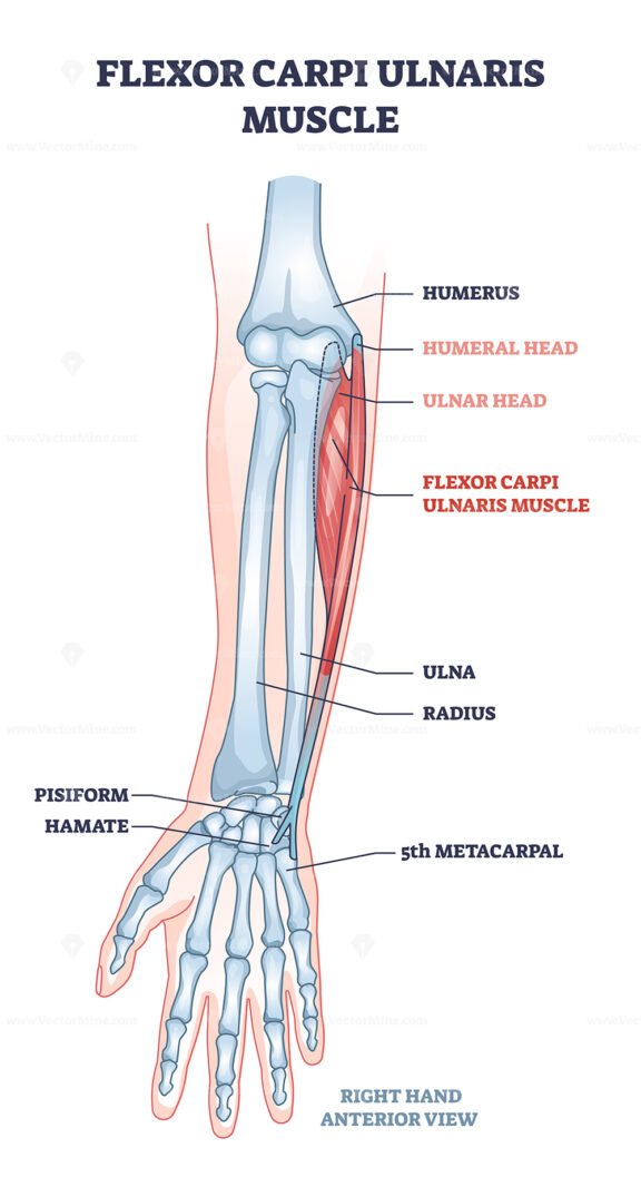 flexor carpi ulnaris outline 1