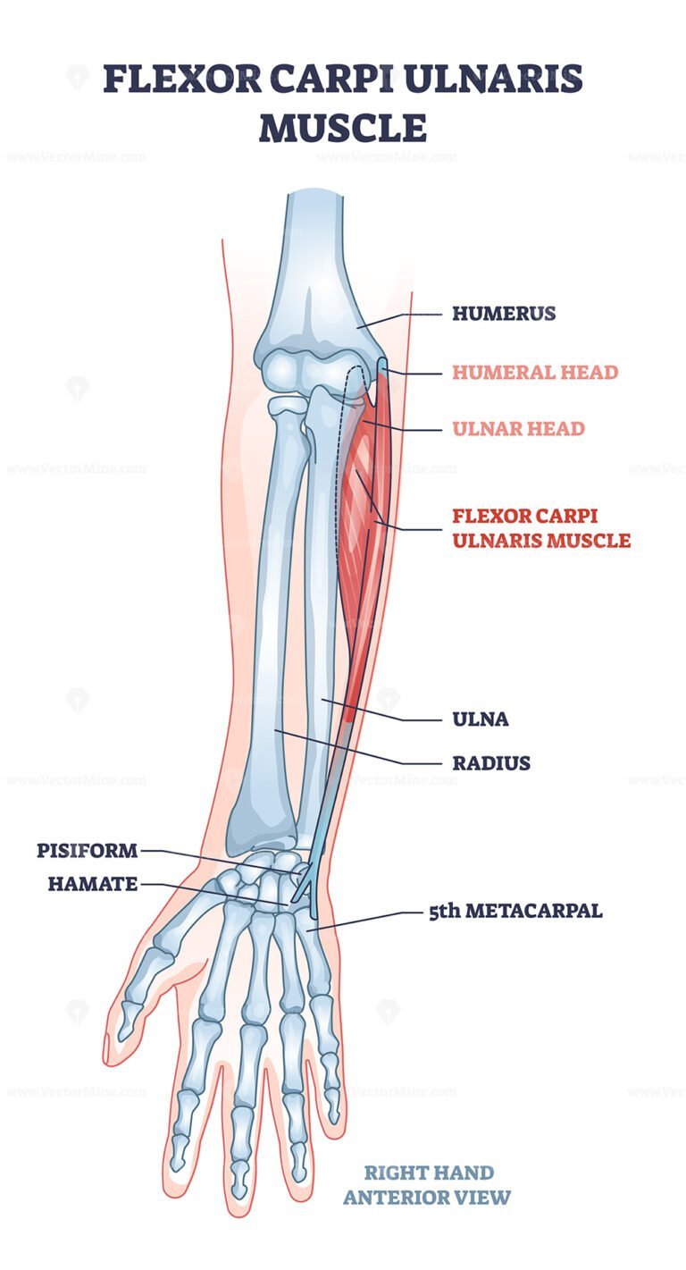 Flexor Carpi Ulnaris Muscle And Human Arm Joint Bones Outline Diagram ...