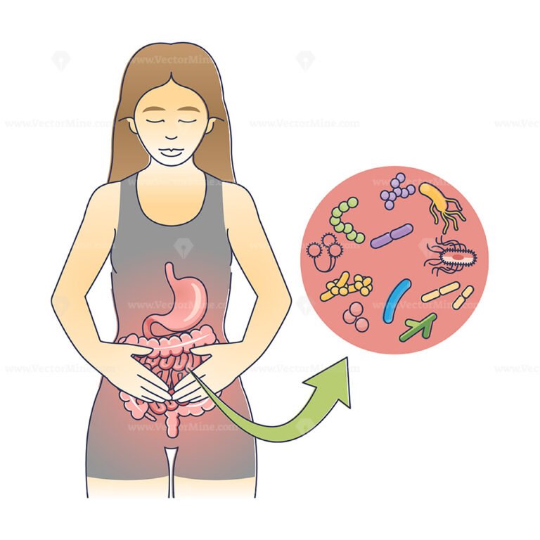 Gastroenteritis as gastrointestinal tract inflammation outline diagram ...