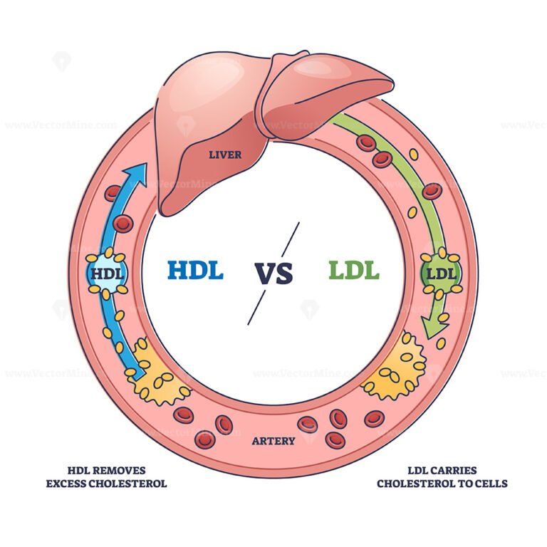 Good HDL and bad LDL cholesterol movement comparison outline diagram ...