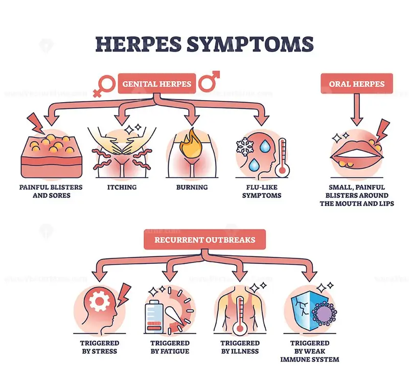 Herpes Symptoms With Genital Oral And Recurrent Outbreaks Outline Diagram Vectormine