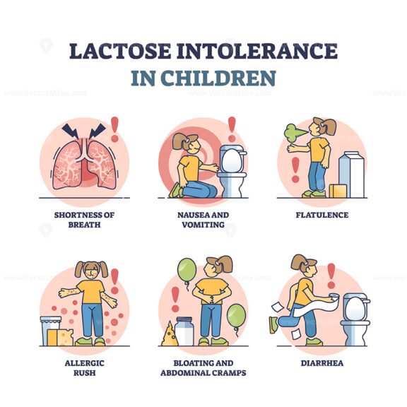 Lactose intolerance in children from milk or dairy allergy outline diagram