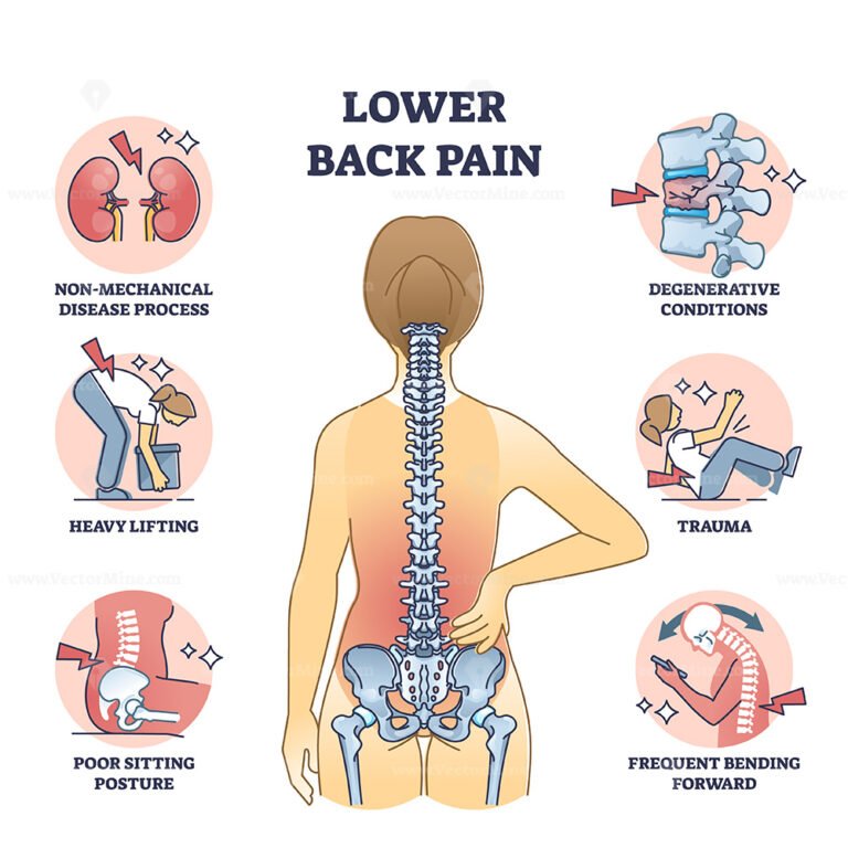 Back pain icons outline showing spine, muscle strain, and pressure ...