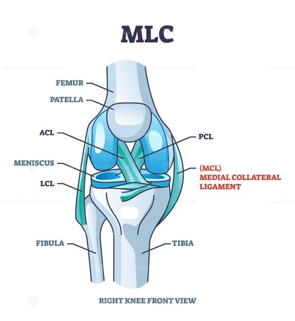 MLC or medial collateral ligament anatomical location in knee outline diagram