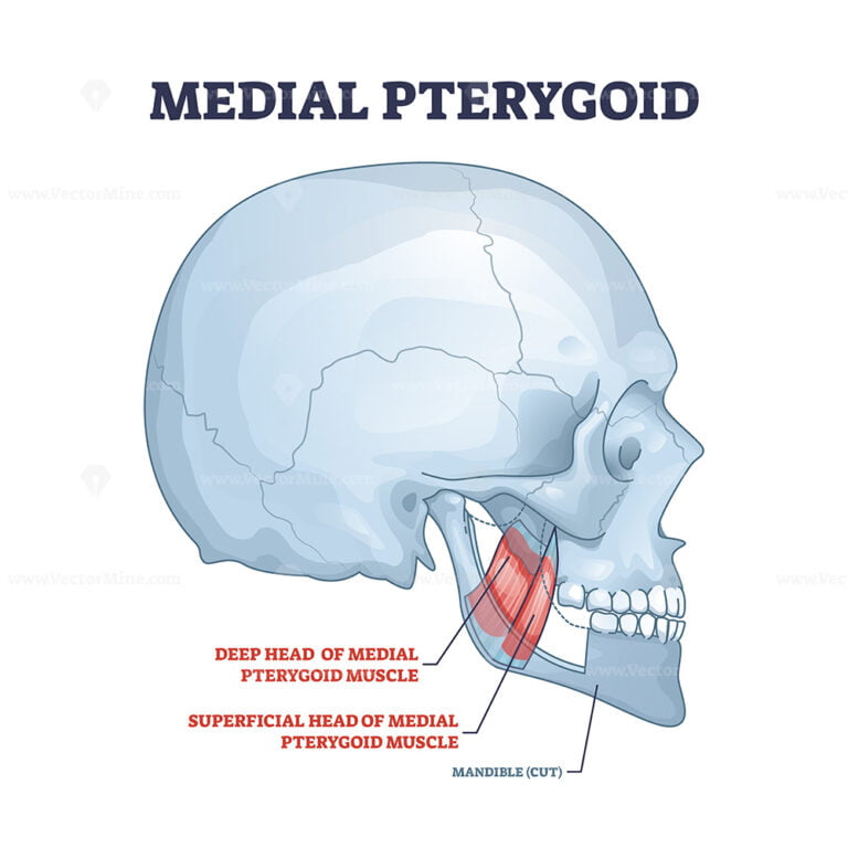 Lateral pterygoid muscle with superior and inferior parts outline ...