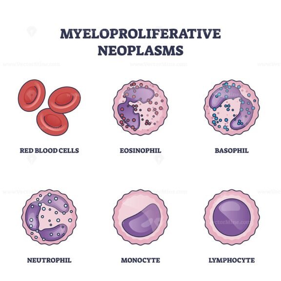 myeloproliferative neoplasms outline diagram 1