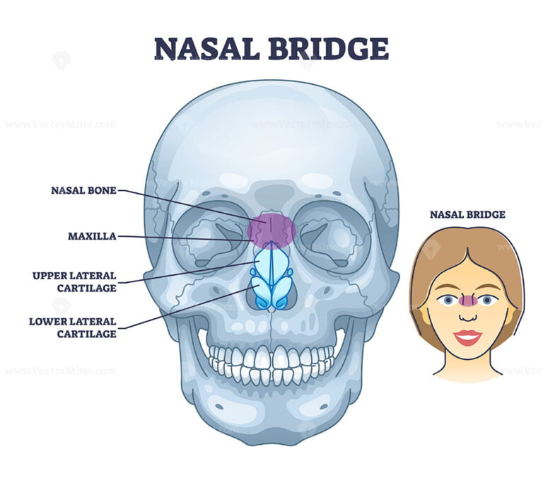 Vomer bone with facial skeleton and frontal nasal cavity outline ...