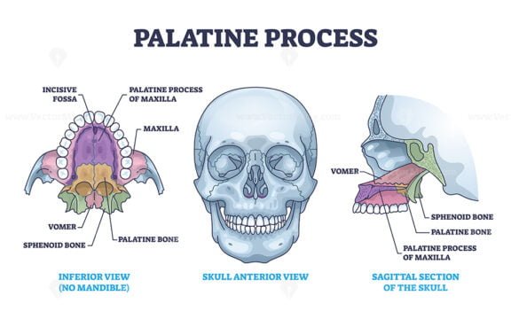 palatine process outline 1