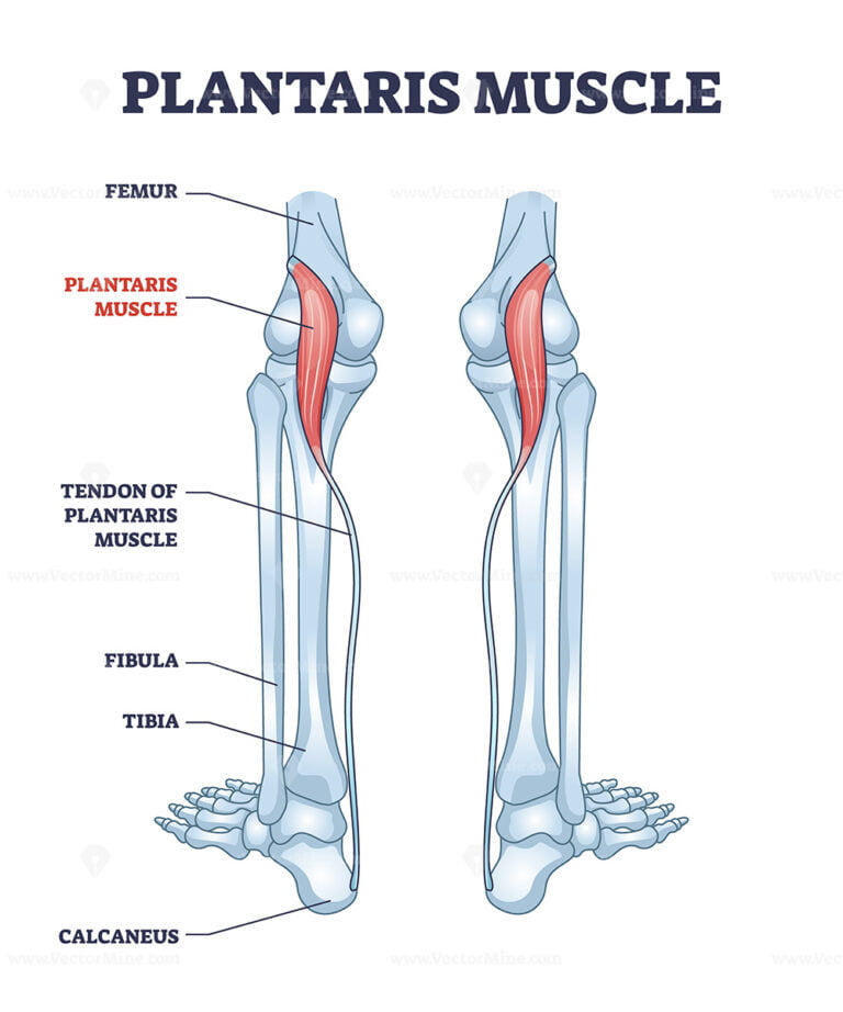 Plantaris muscle as leg superficial posterior compartment outline ...