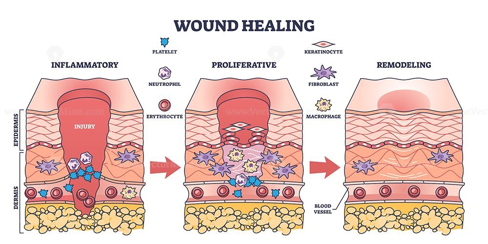 Process of wound healing and anatomical body injury repair outline ...