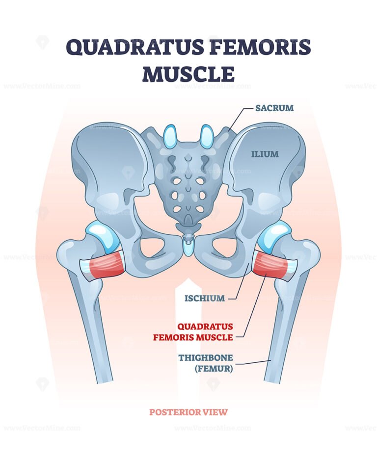 Levator ani muscle group location and lesser pelvis bones outline ...