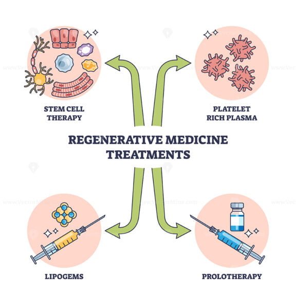 Regenerative Medicine Treatment Methods For Patient Cure Outline ...