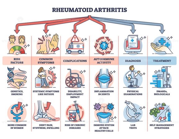 rheumatoid arthritis diagram outline 1