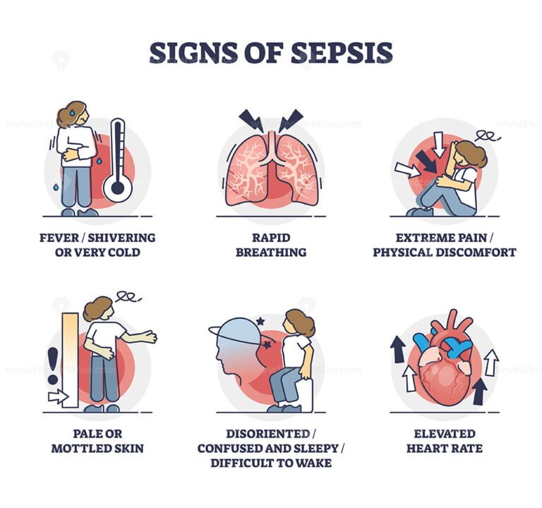 Signs Of Sepsis As Infection Blood Poisoning Symptoms Outline ...