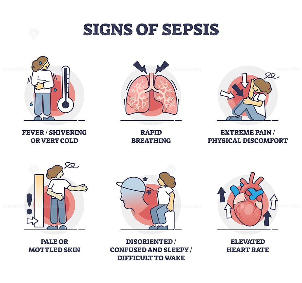 Signs Of Sepsis As Infection Blood Poisoning Symptoms Outline ...