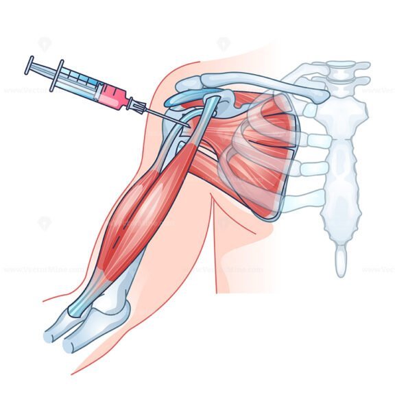 stem cell therapy outline 1